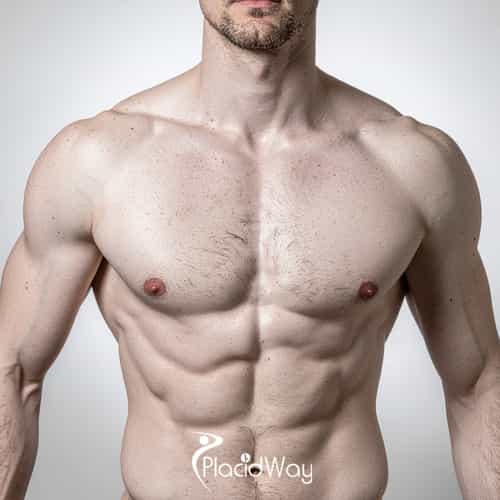 7 Gynecomastia Surgery Options in South Korea That Are Attracting Male Patients From the UK and UAE